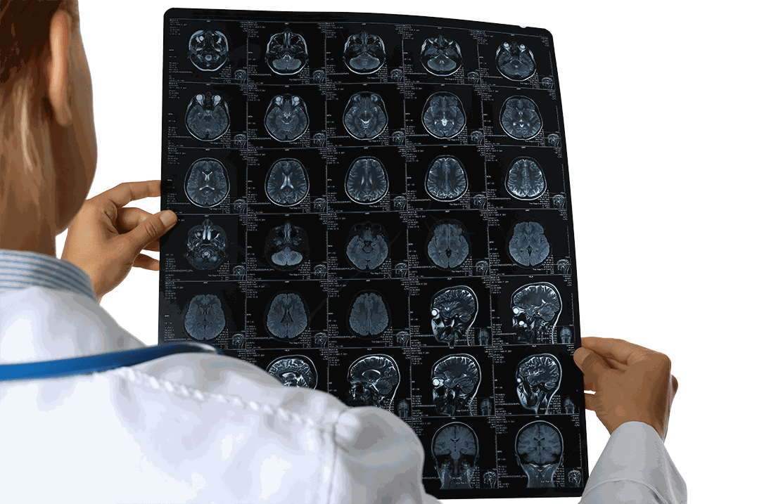 GNMI MRI Exam Analysis