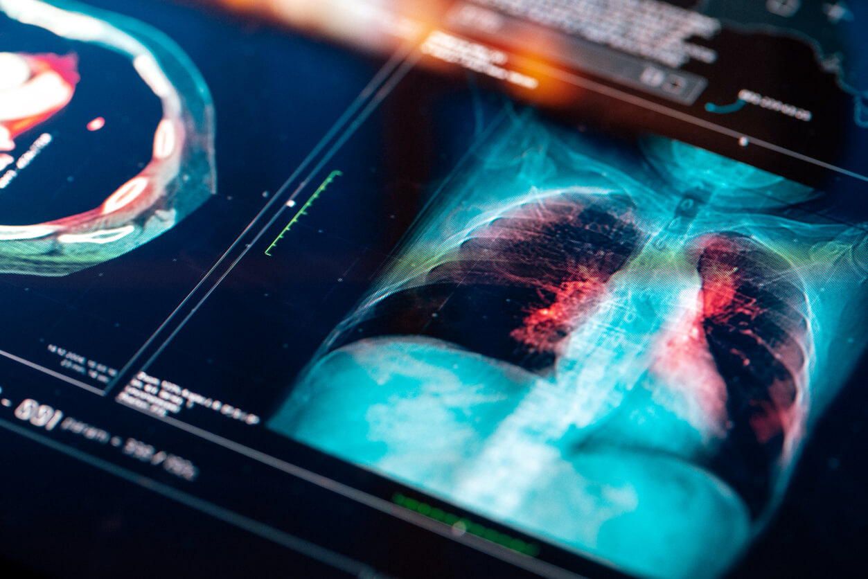 Nuclear Medicine