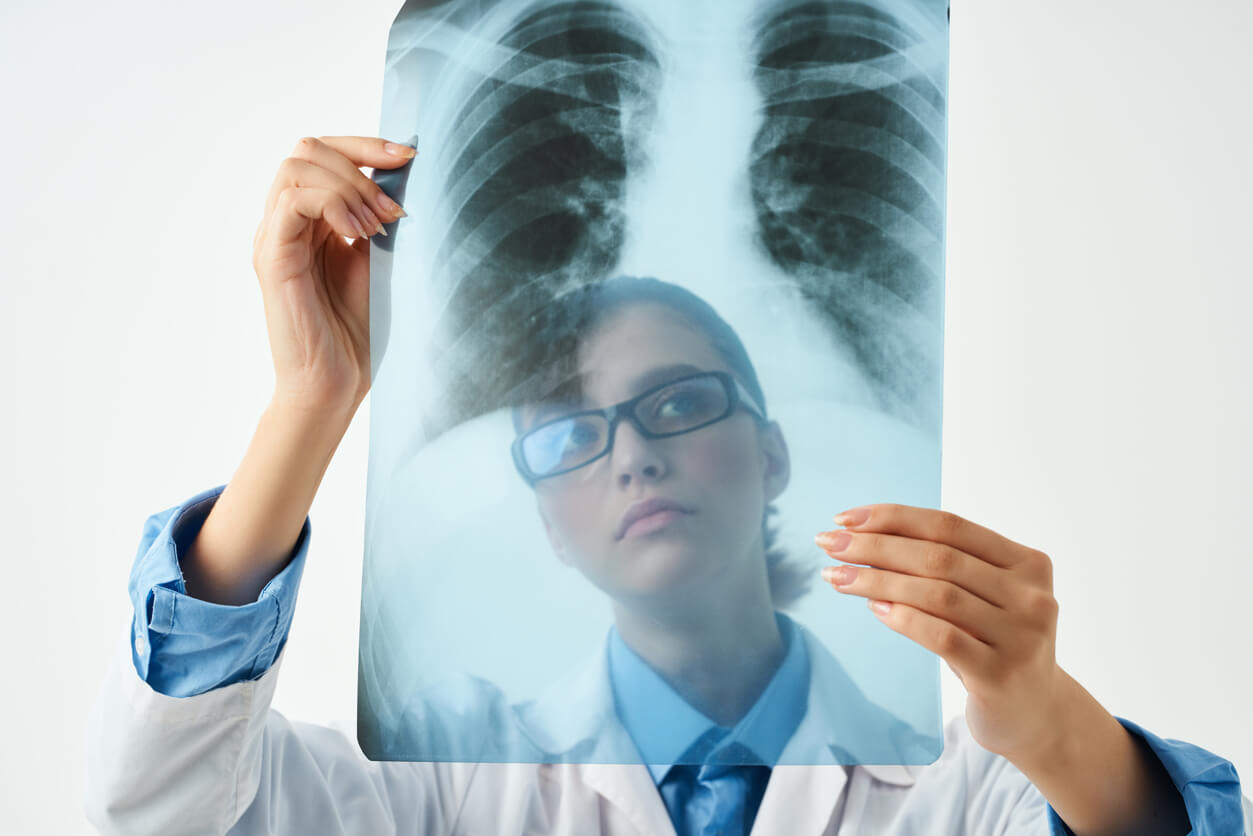X-Ray