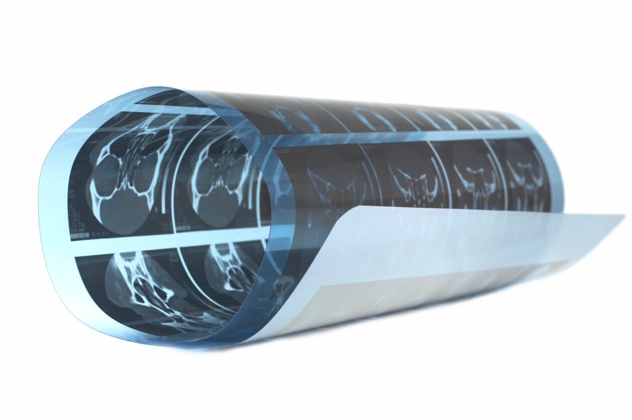 Wholebody Ct Scan